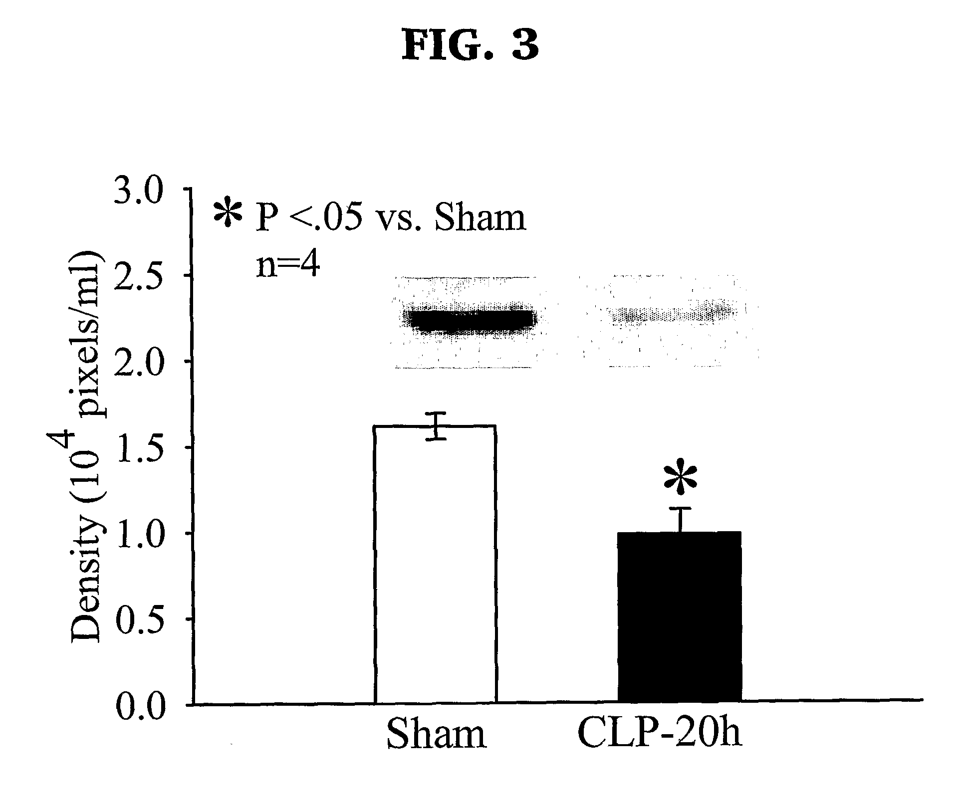 Milk fat globule epidermal growth factor—factor VIII and sepsis