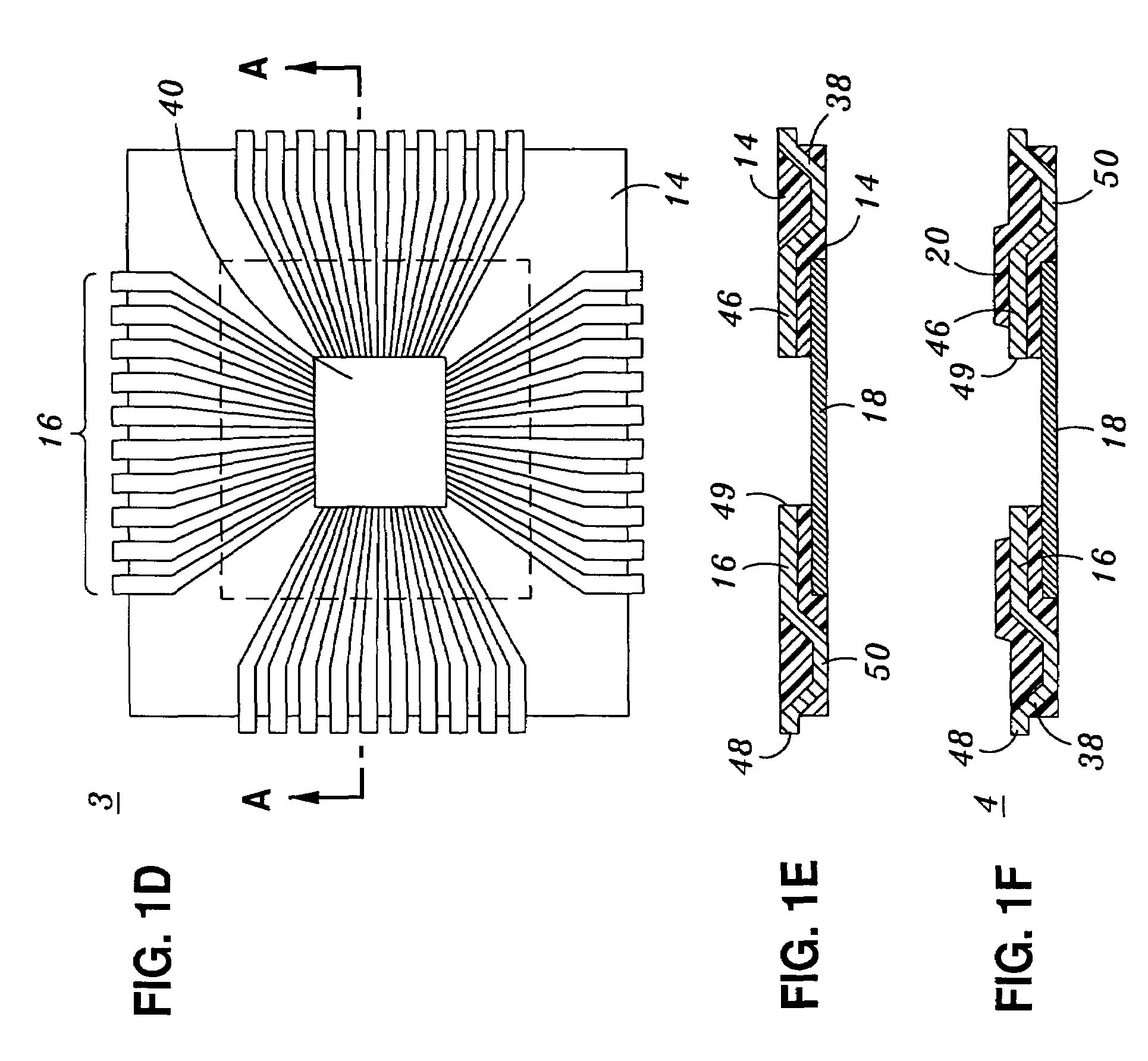 Exposed lead interposer leadframe package