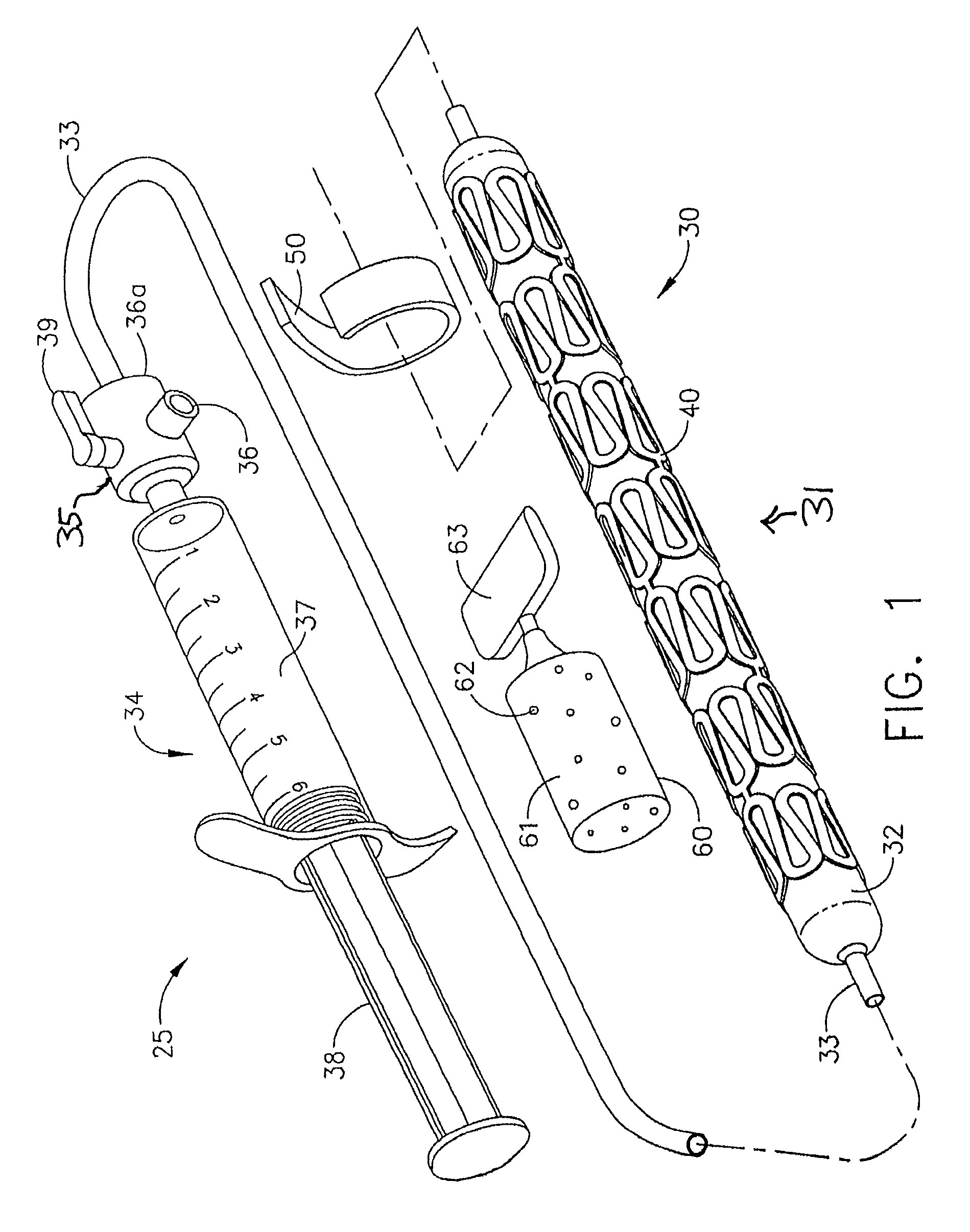 Method of performing an end-to-end anastomosis using a stent and an adhesive