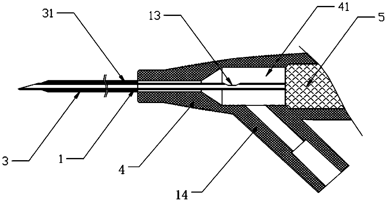 Remaining needle with quick blood returning function