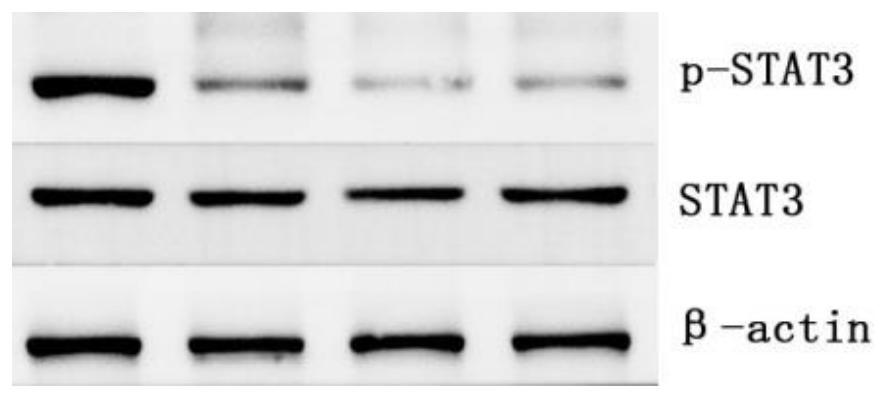 Application of traditional Chinese medicine toosendanin in preparation of product for preventing and treating glioma of nervous system