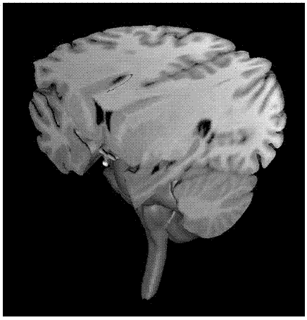 Method for constructing three-dimensional brain model