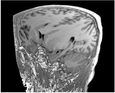 Method for constructing three-dimensional brain model