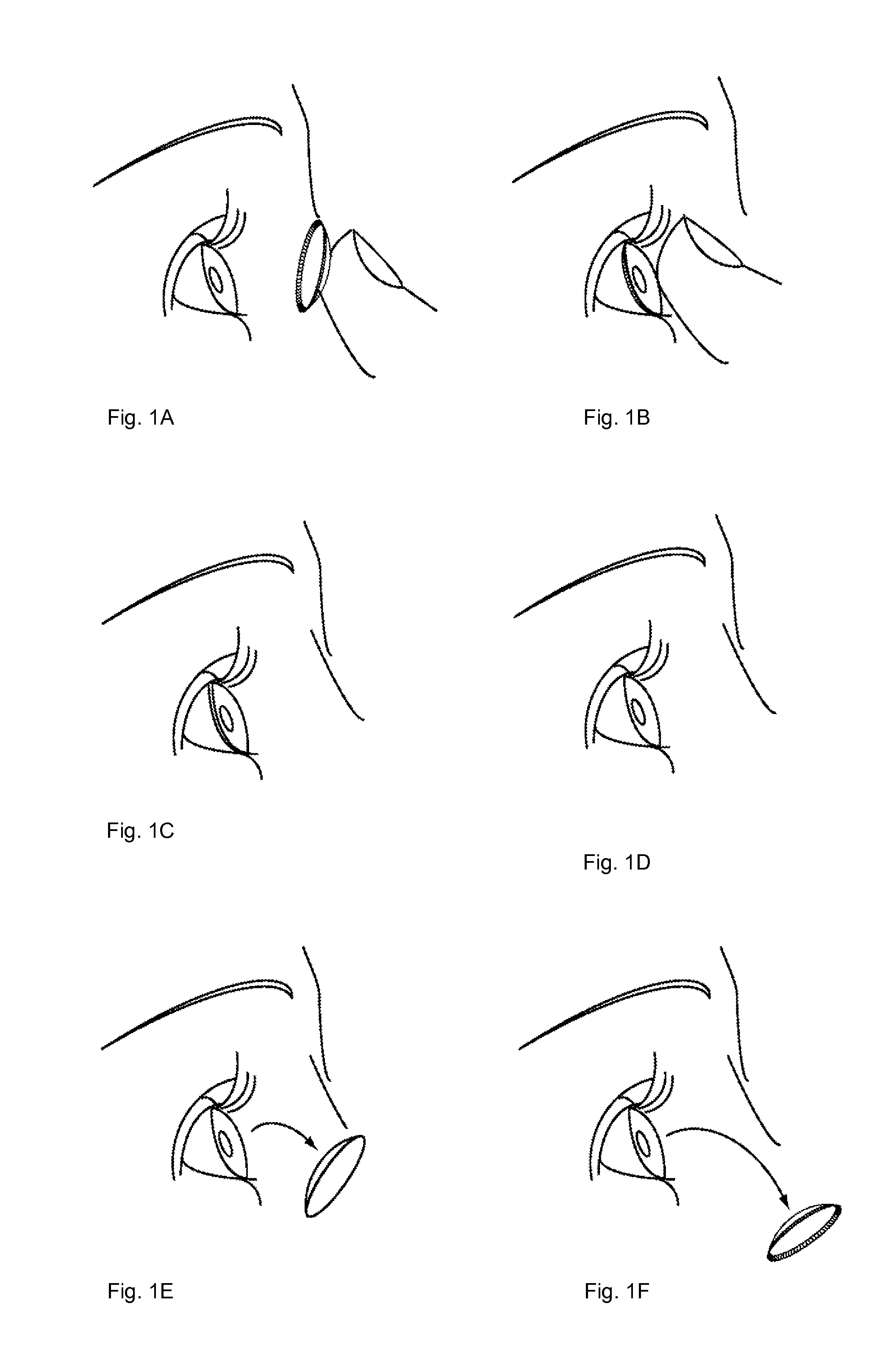 Methods materials and systems for producing a contact lens and contact lenses produced using said methods materials and systems