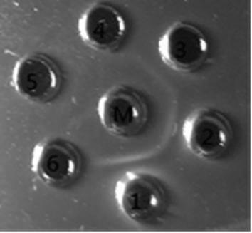 Cell-adapted strain of supervirulent chicken infectious bursal disease virus and its application