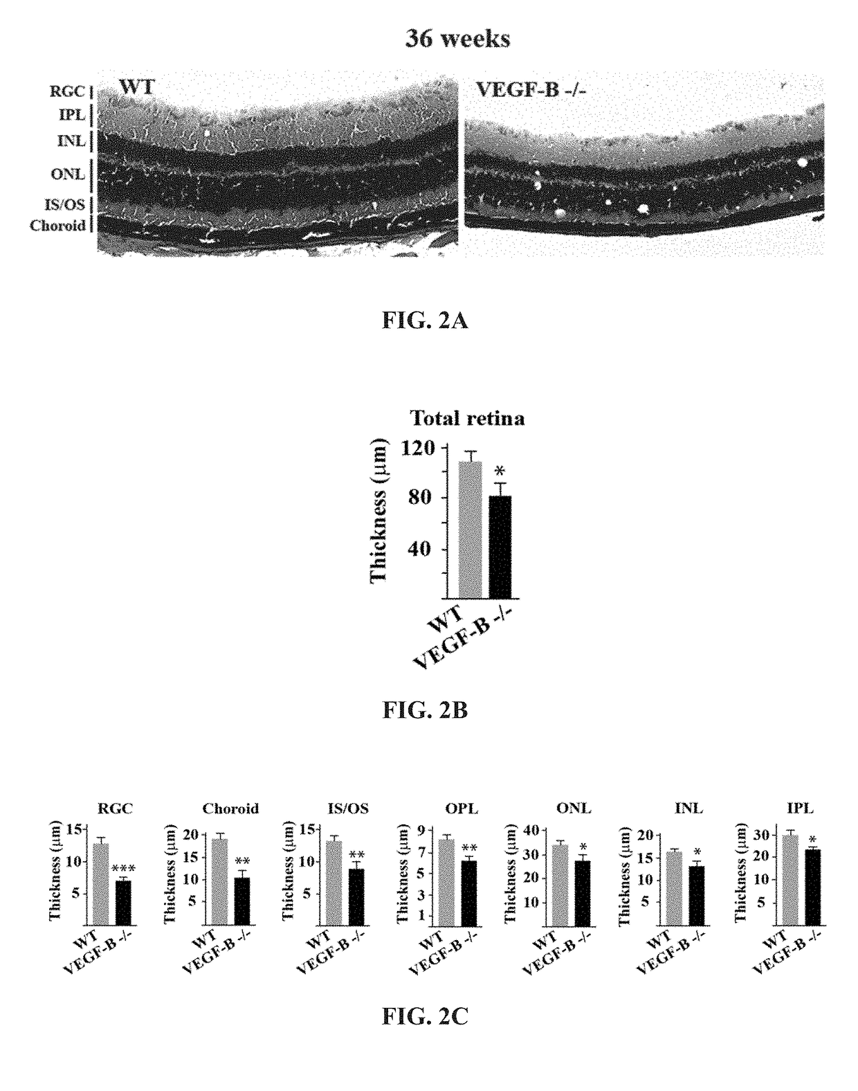 Use of vegf-b for treating diseases induced by oxidative injury