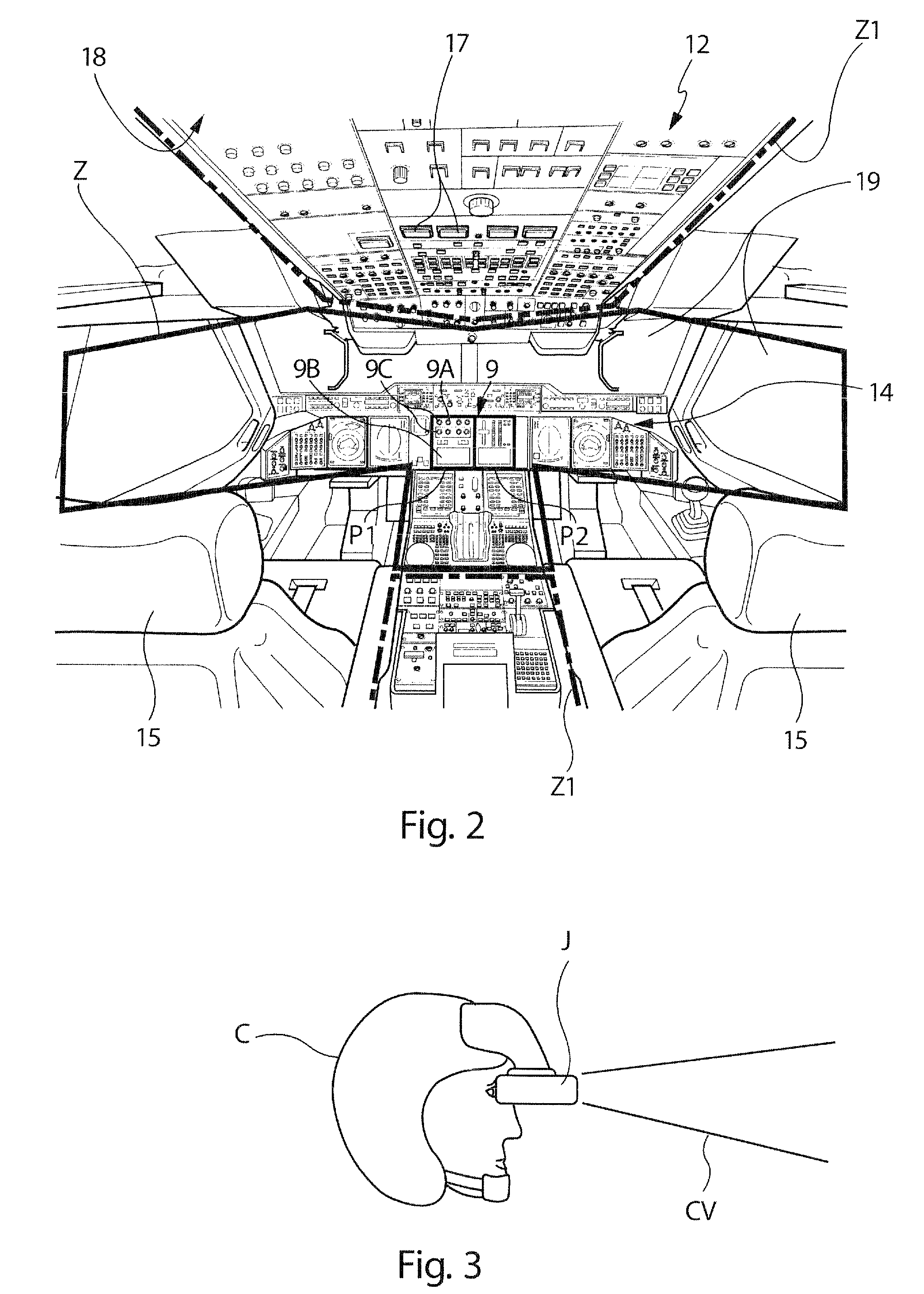 Installation for detecting and displaying the failures of the functional systems of an aircraft
