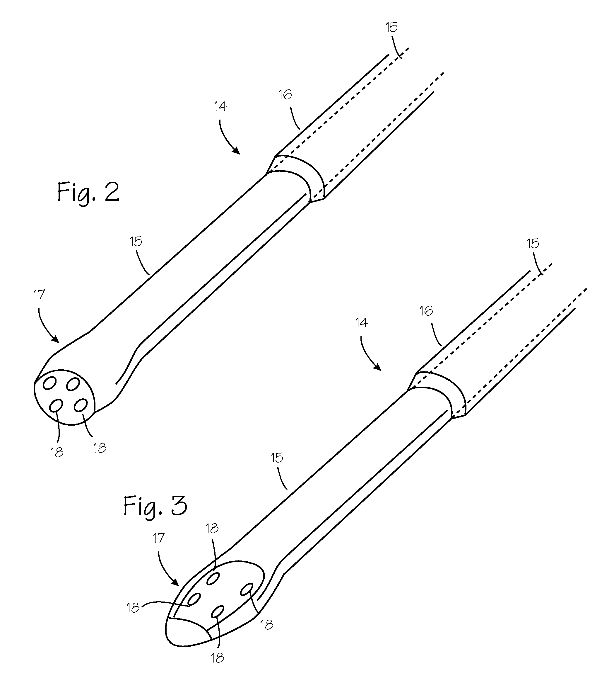 Method and Devices for Treating Damaged Articular Cartilage