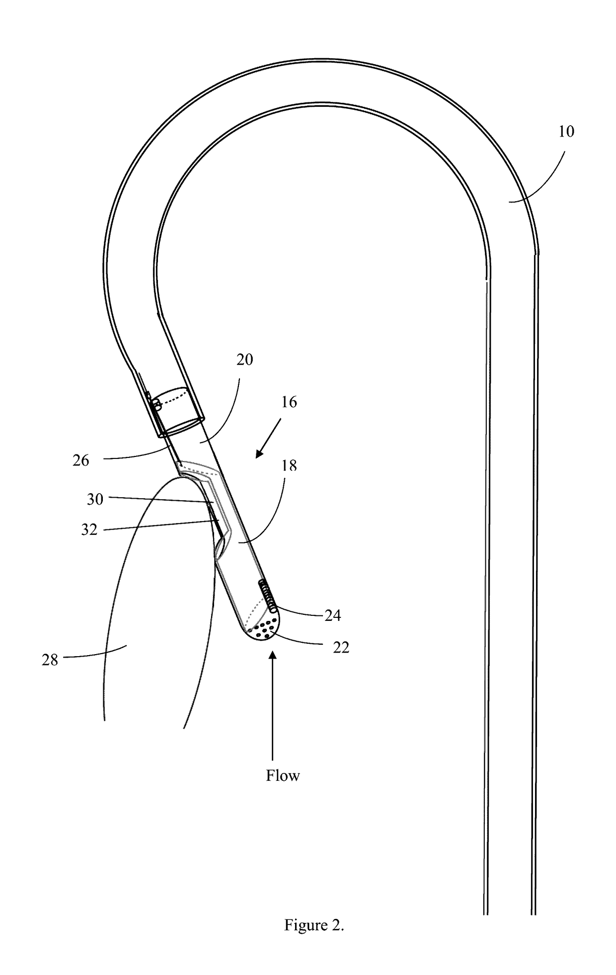 Device for the treatment of hypertrophic cardiomyopathy