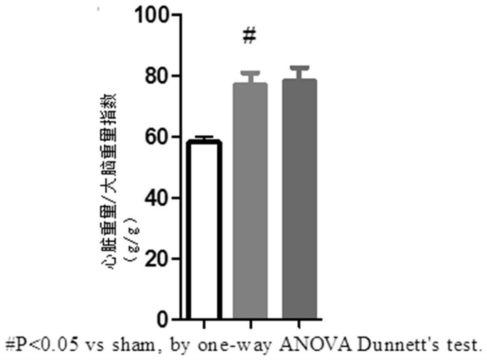 Application of ester-containing aromatic propionamide compounds and their metabolites in the preparation of drugs for the treatment of heart failure