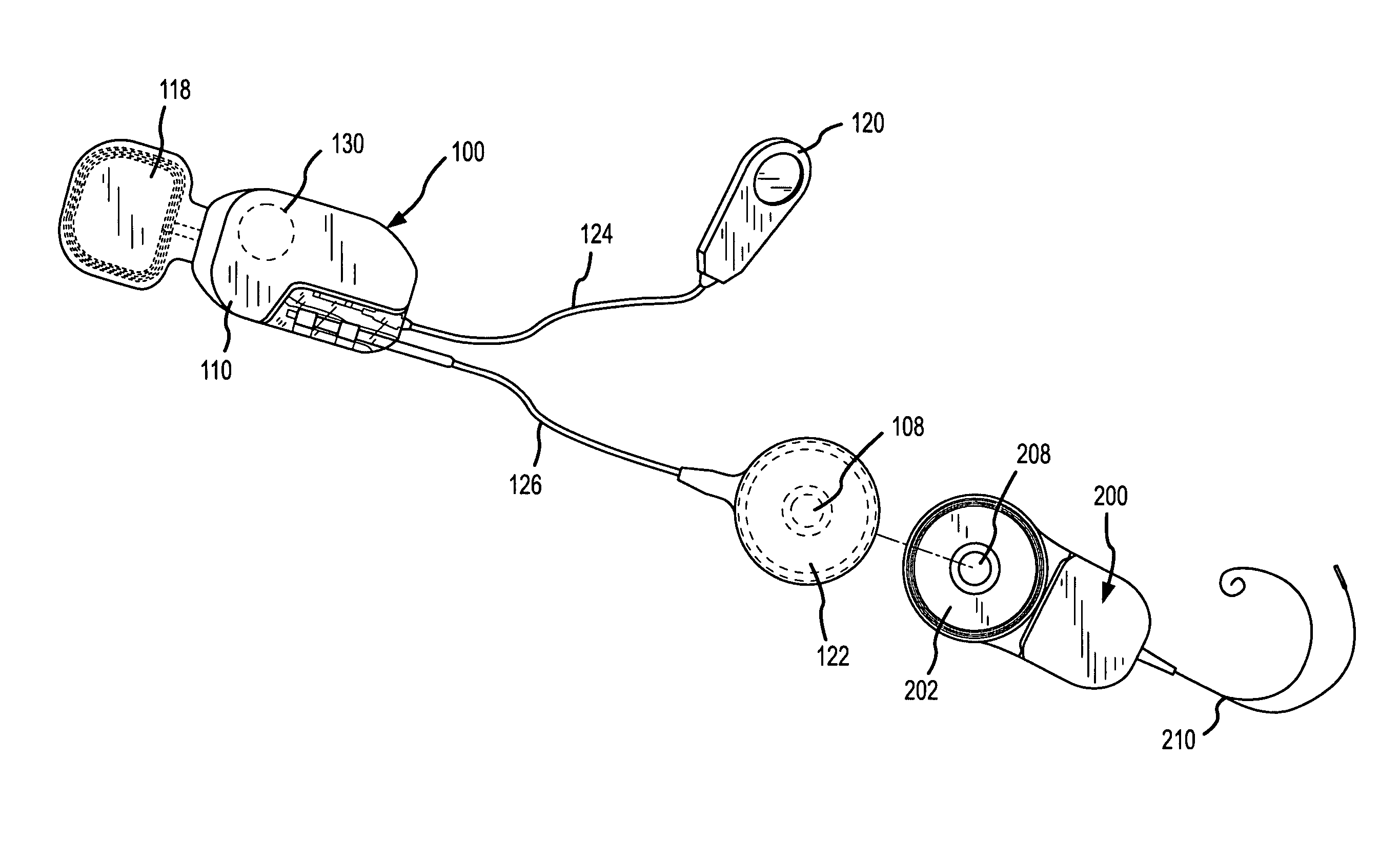Integrated implantable hearing device, microphone and power unit
