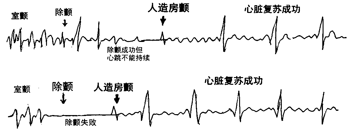 Artificial atrial fibrillation cardiac resuscitation device and control method thereof