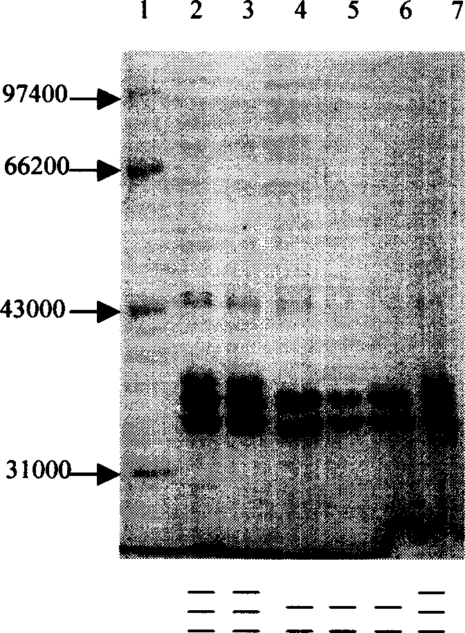 Chicken escherichia coli heterotype outer membrane protein cell engineered bacterial strain preparing method