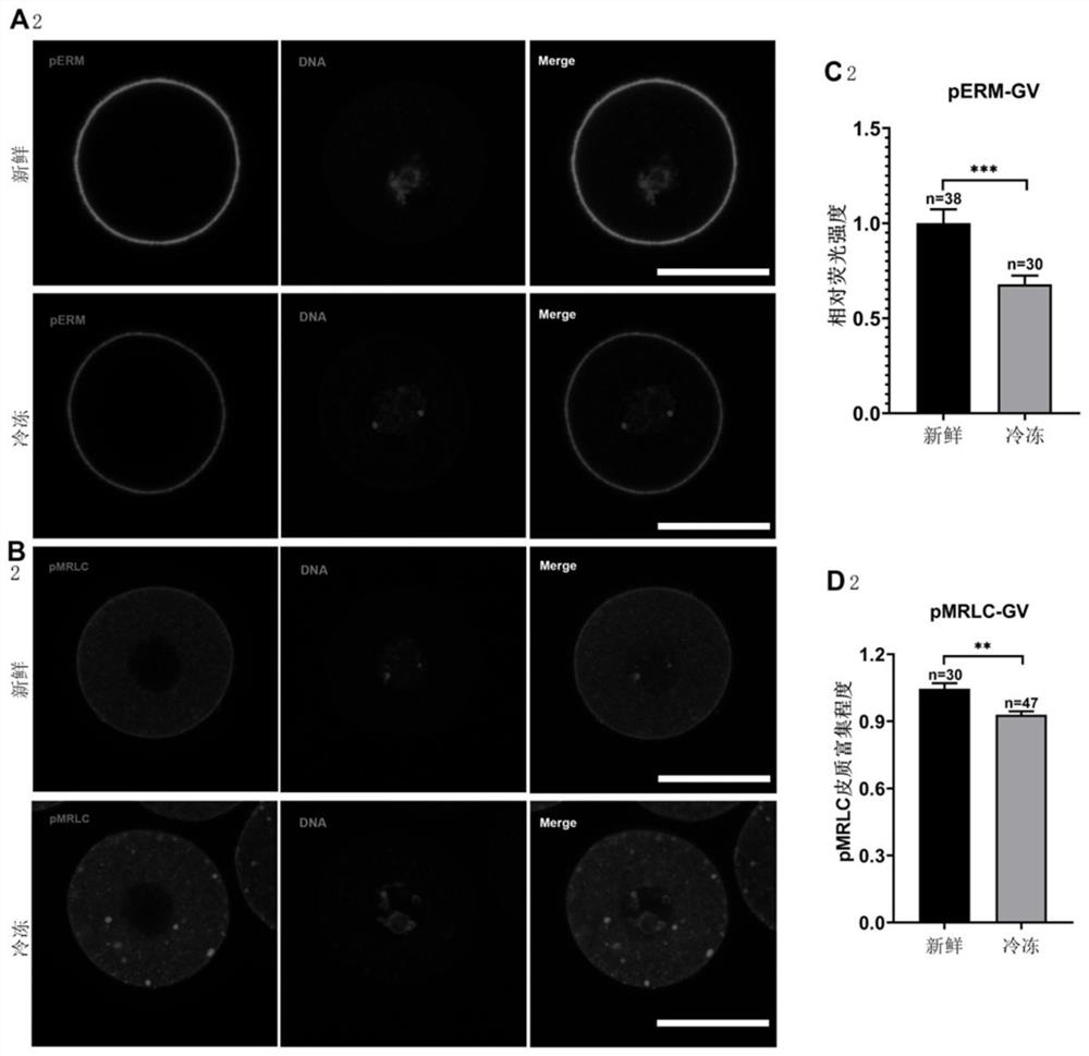 Culture solution for improving in-vitro culture quality of frozen oocytes and application of culture solution