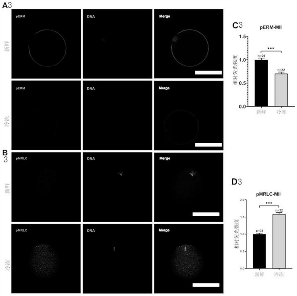 Culture solution for improving in-vitro culture quality of frozen oocytes and application of culture solution