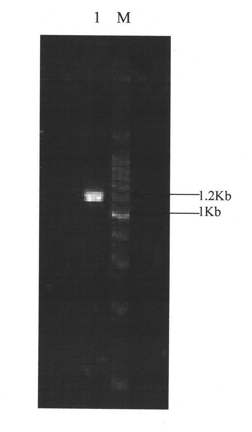 Human TSHR extracellular fusion protein and preparation method thereof