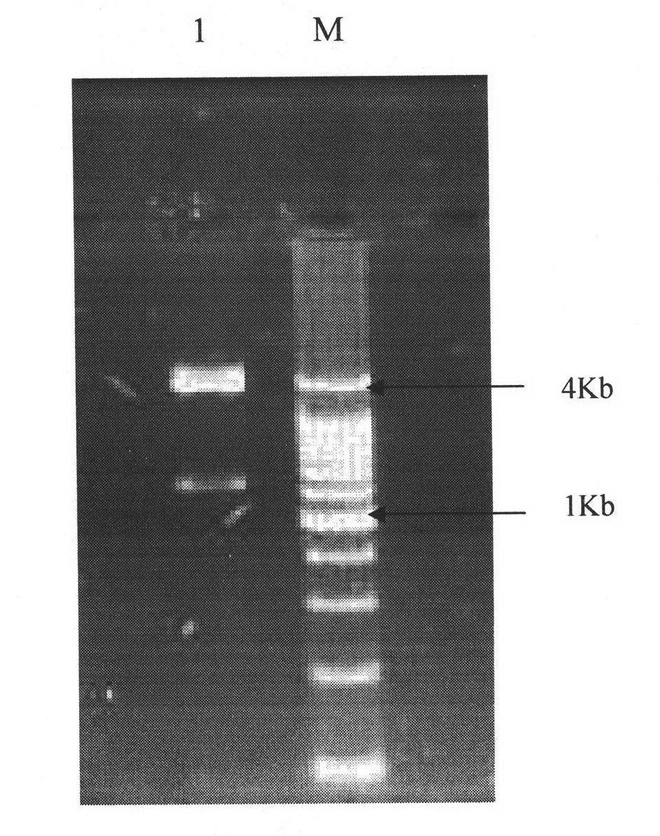 Human TSHR extracellular fusion protein and preparation method thereof