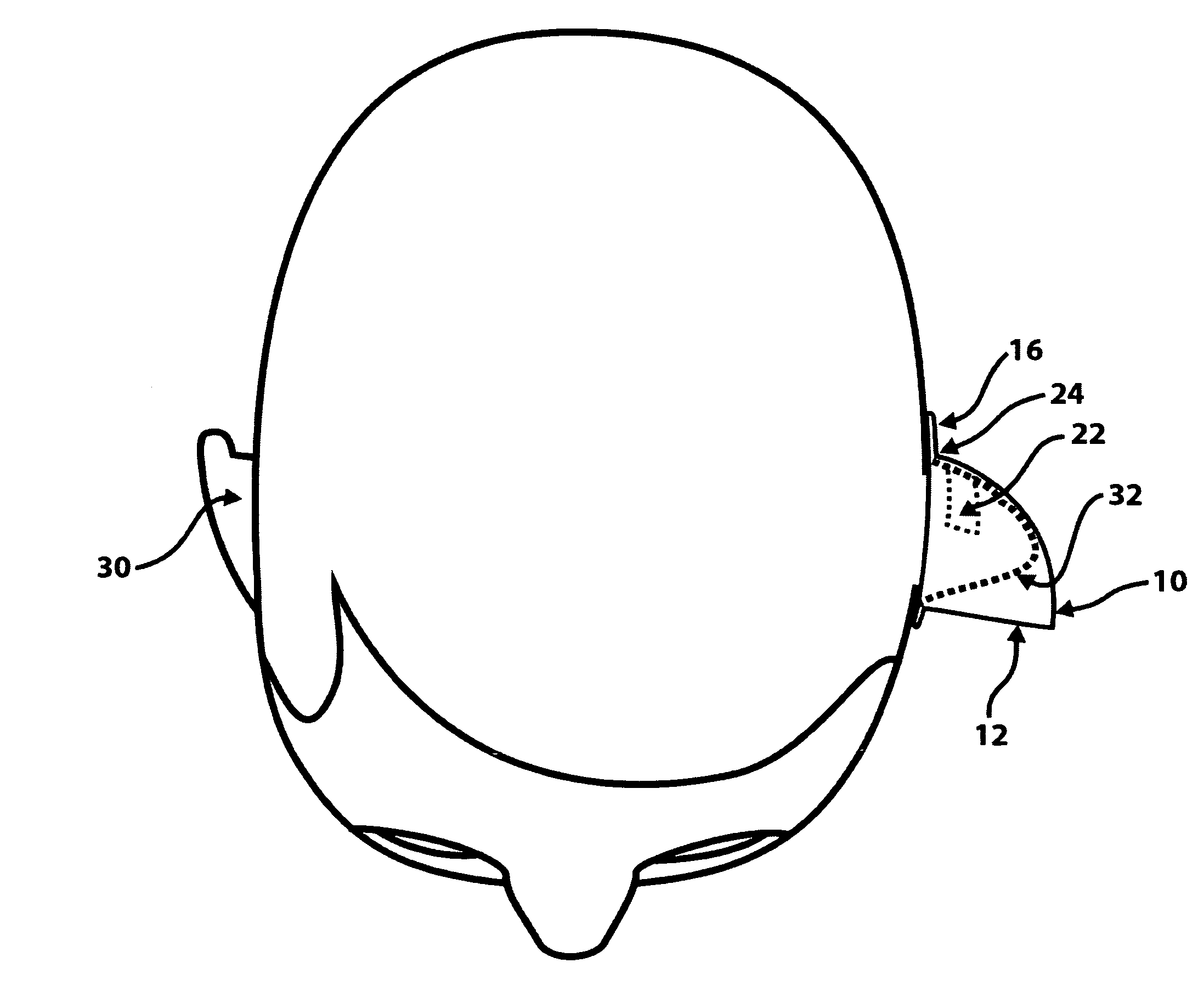 Ear-mounted lenticular acoustic reflector