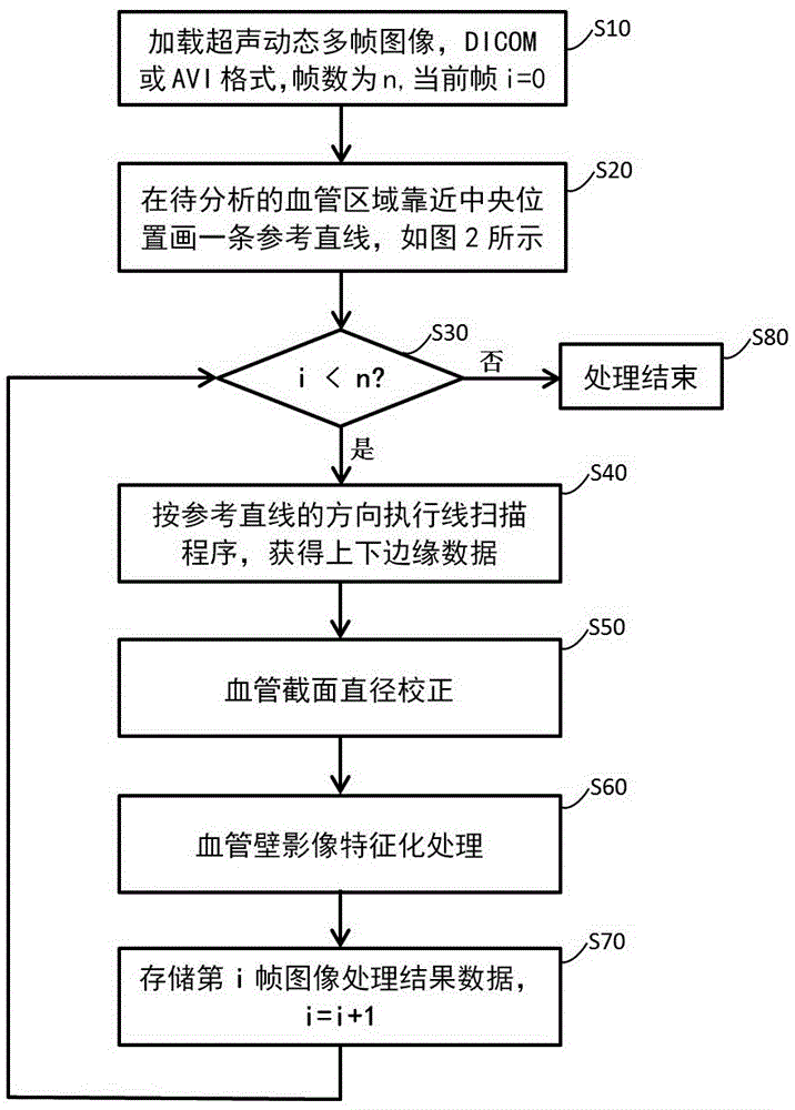 Method and system for rapid and automatic acquisition of vessel edge morphology in dynamic ultrasound images