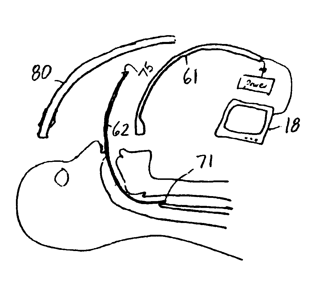 Apparatus for introducing an airway tube into the trachea having visualization capability and methods of use