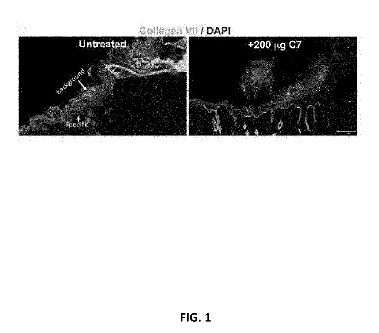 Recombinant c7 and methods of use