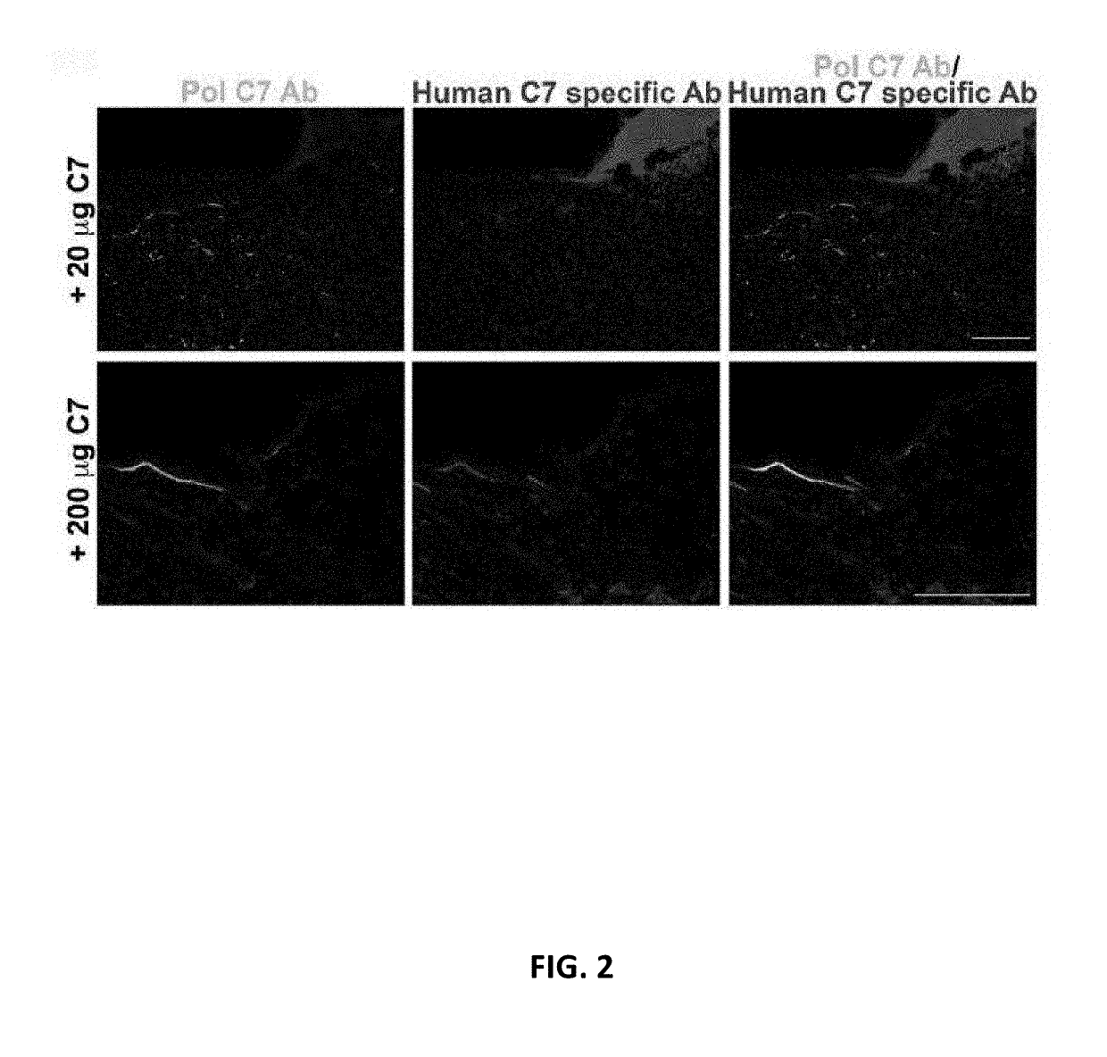 Recombinant c7 and methods of use