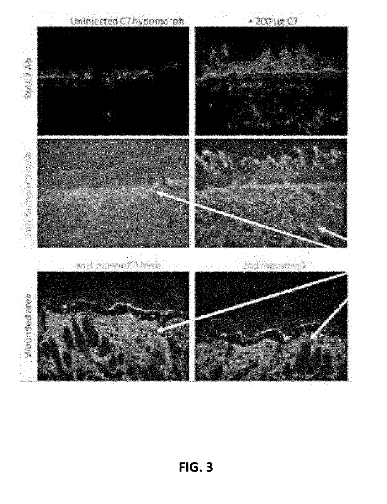 Recombinant c7 and methods of use