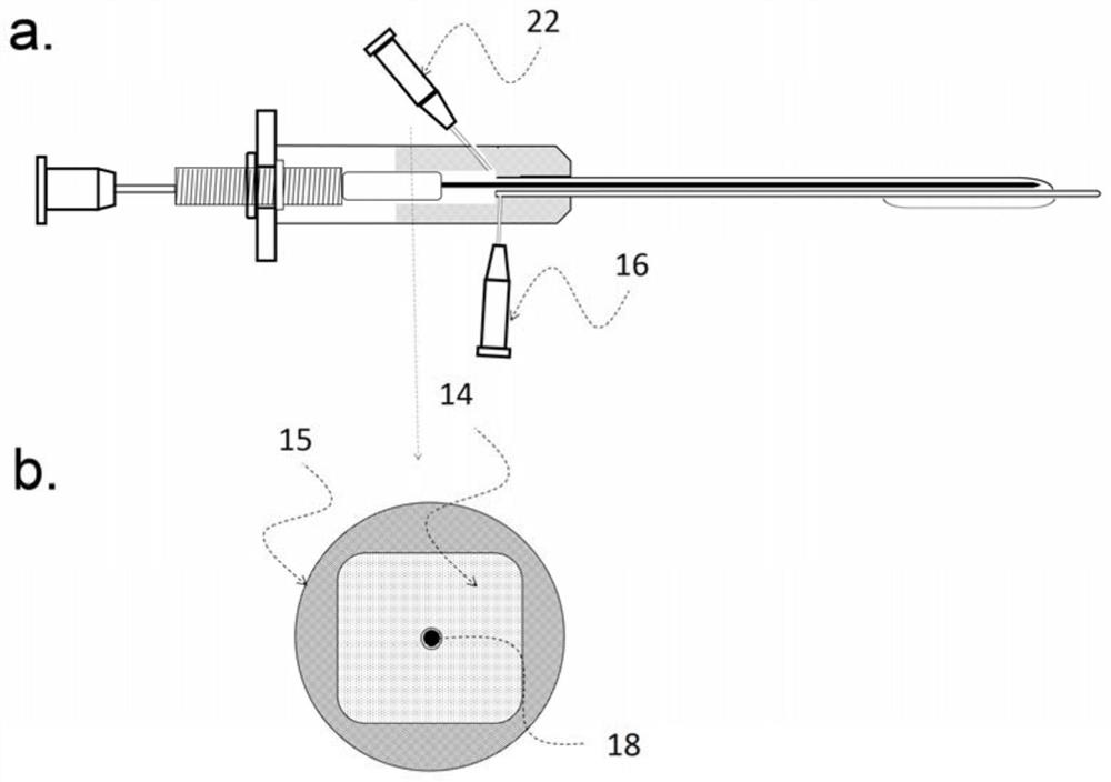 A kind of multifunctional balloon catheter and system