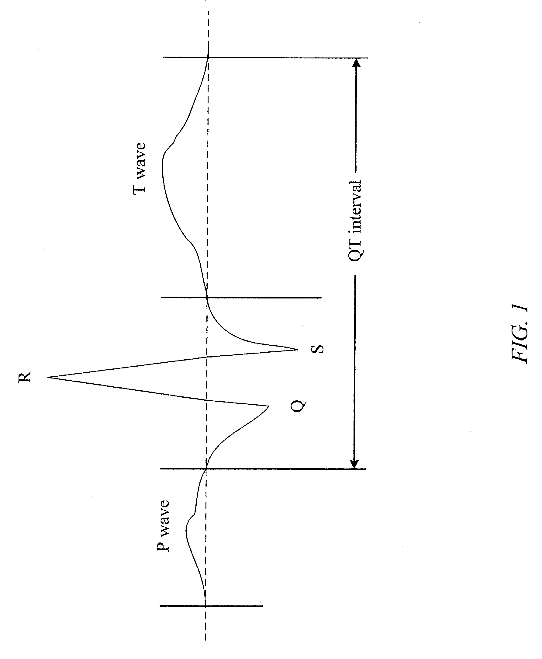 System and method for diagnosing and treating long qt syndrome