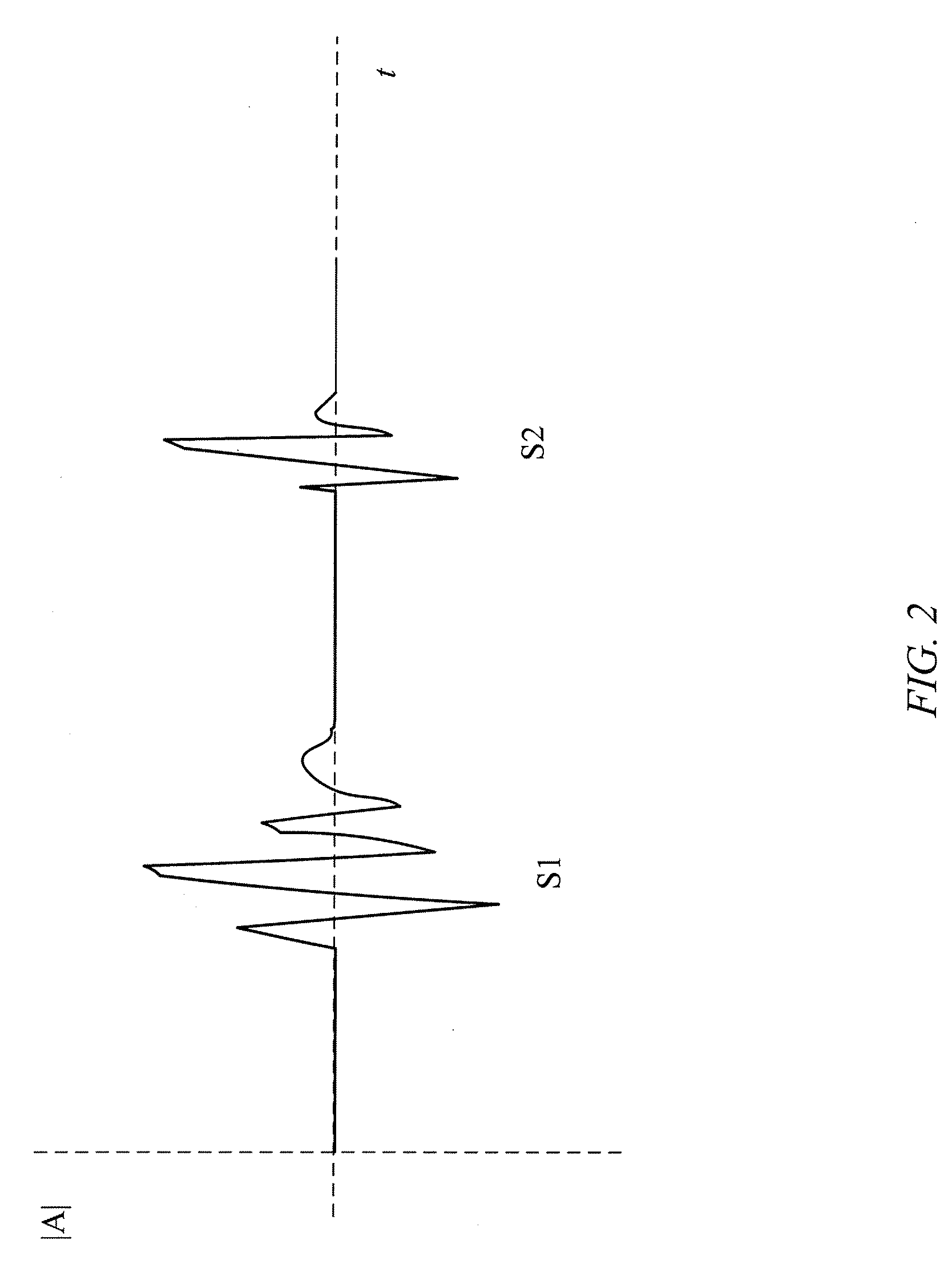 System and method for diagnosing and treating long qt syndrome
