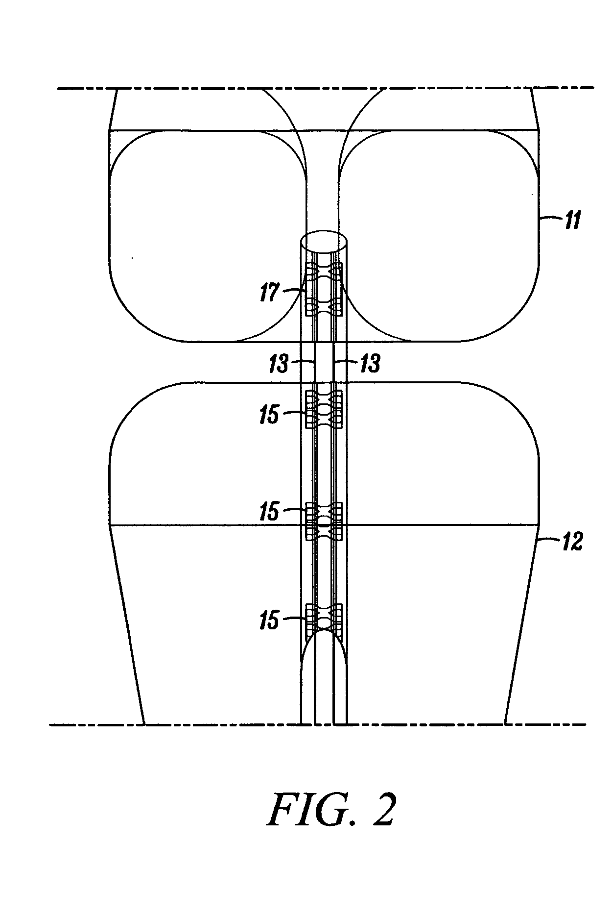 Devices, systems and methods for material fixation