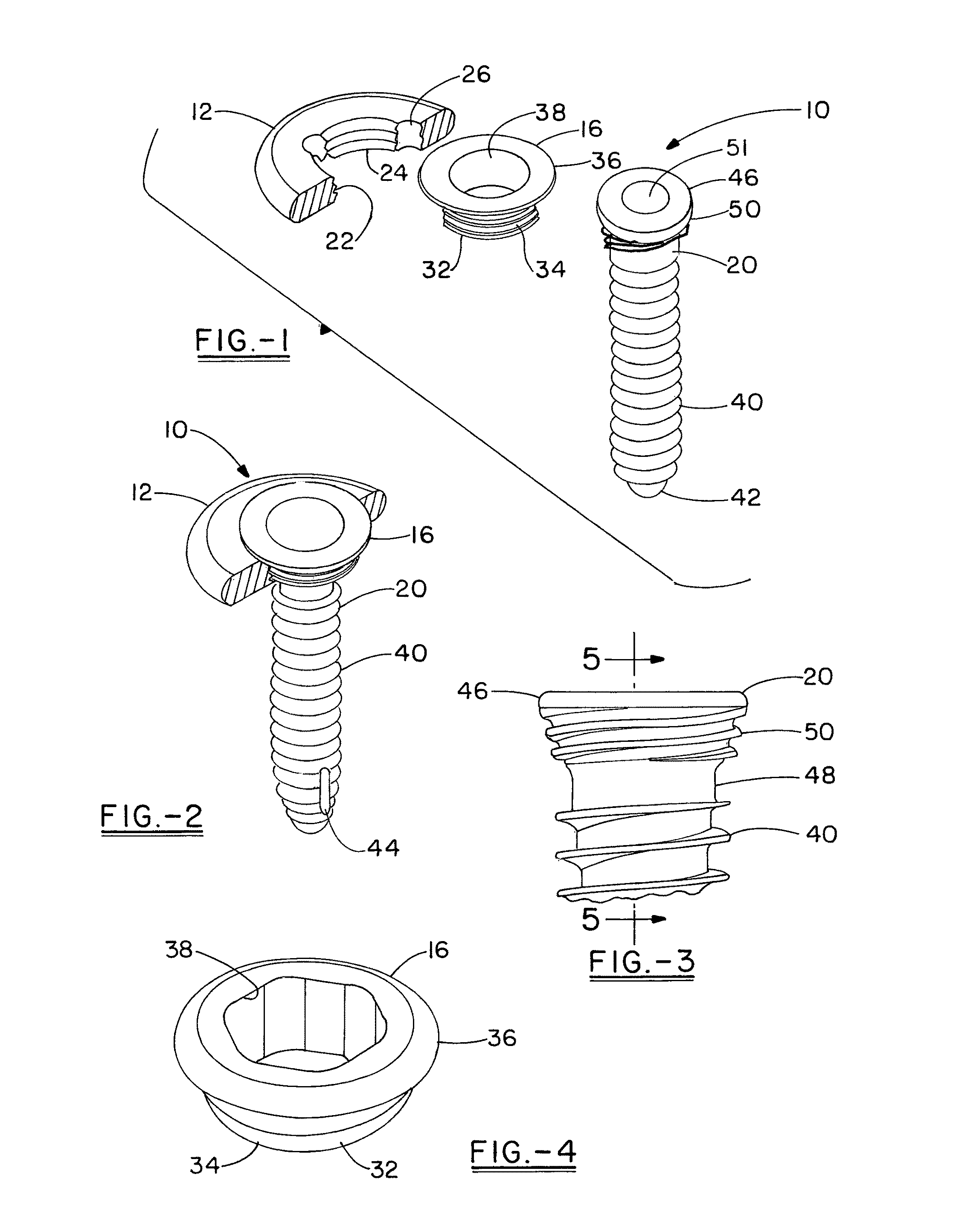System for achieving selectable fixation in an orthopedic plate