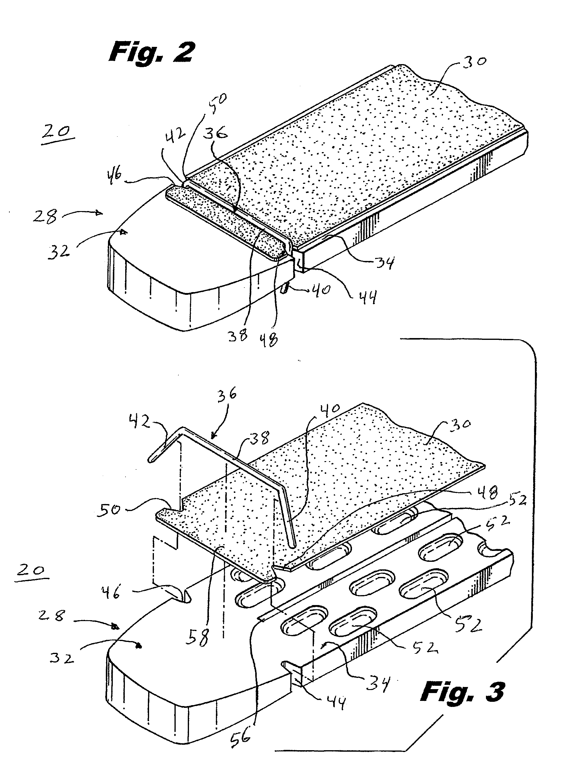 Crimp And Release Of Suture Holding Buttress Material