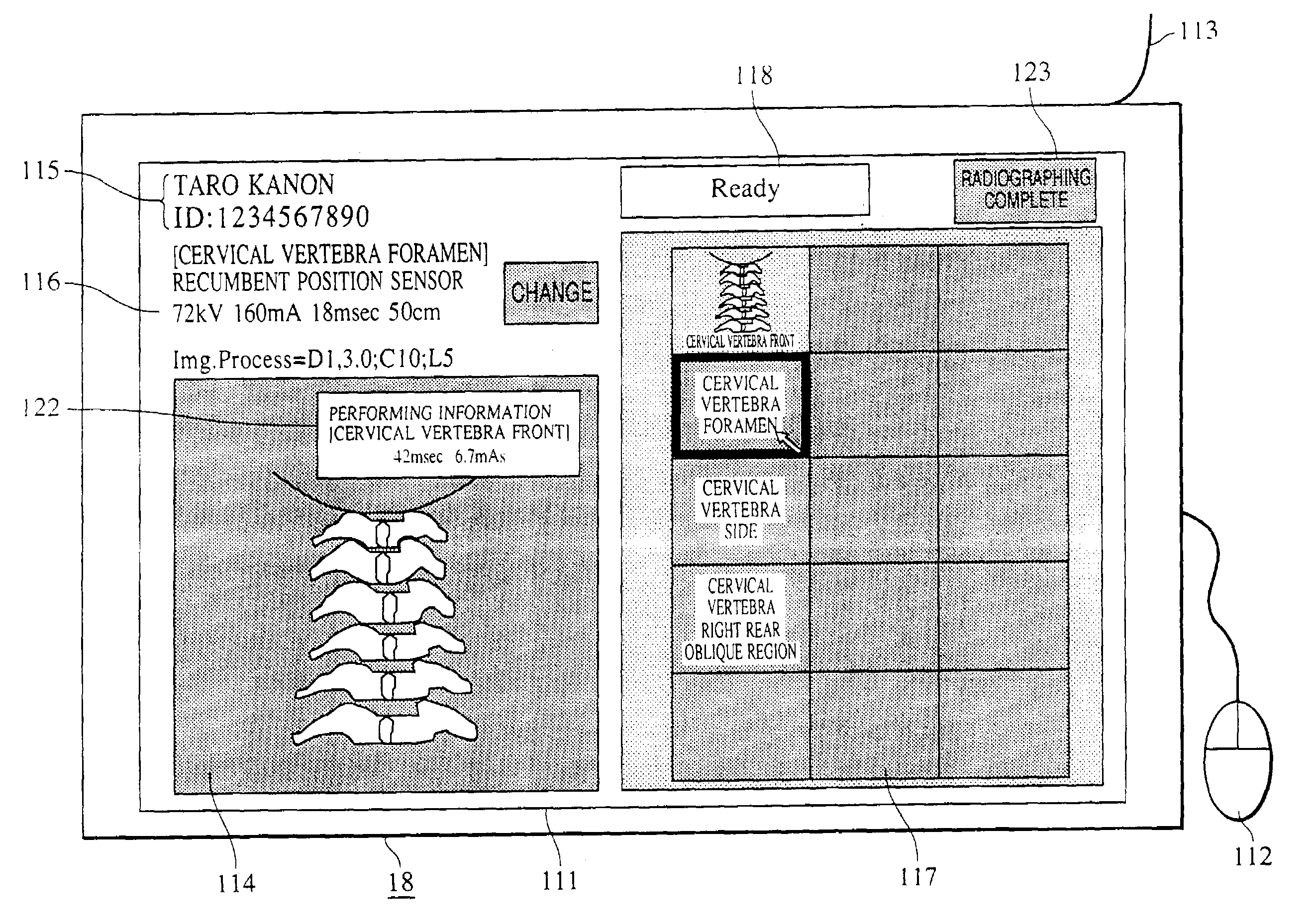 Examination system, image processing apparatus and method, medium, and X-ray photographic system