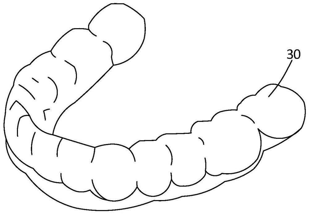 Manufacturing method of tooth beautifying braces