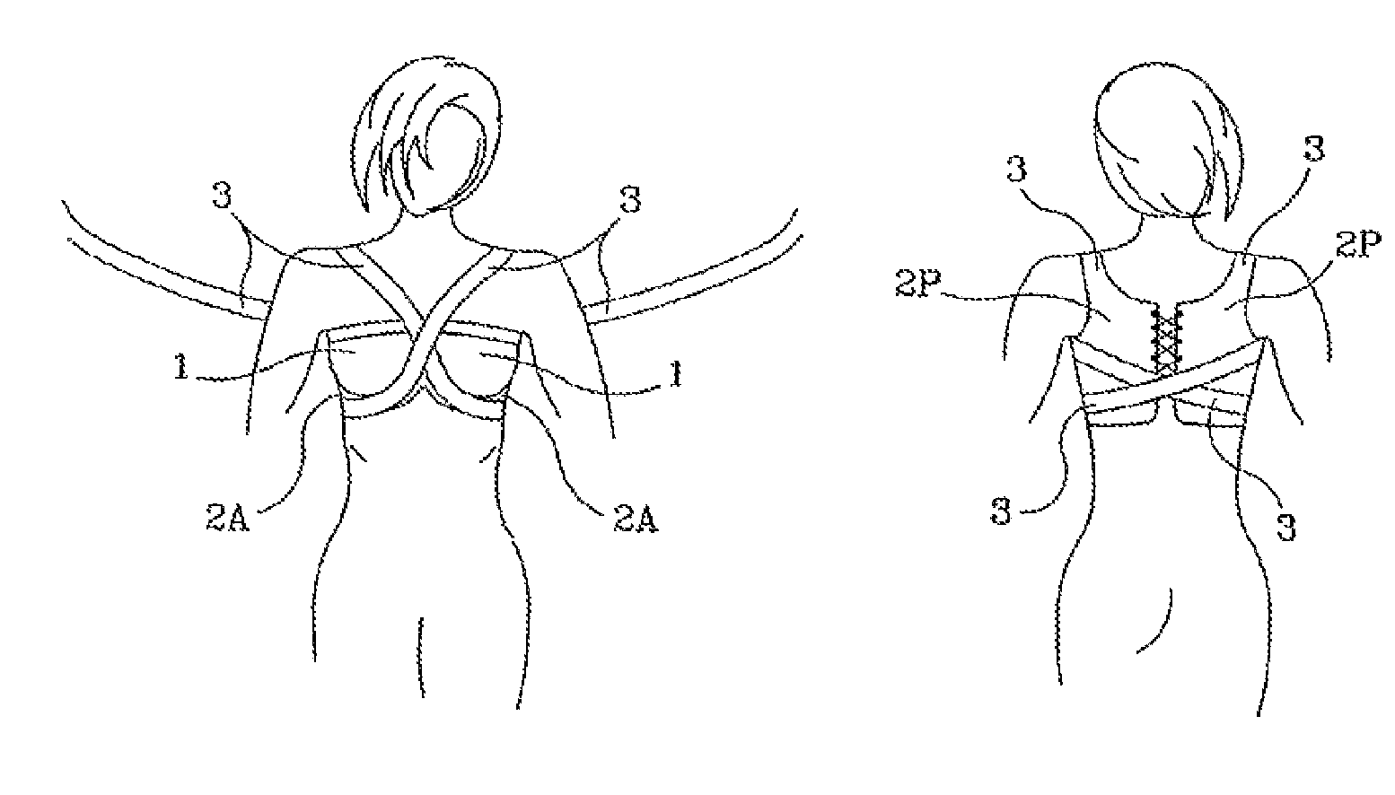 Post-surgical medical device for quadrectomy, mastectomy and/or mammary surgery
