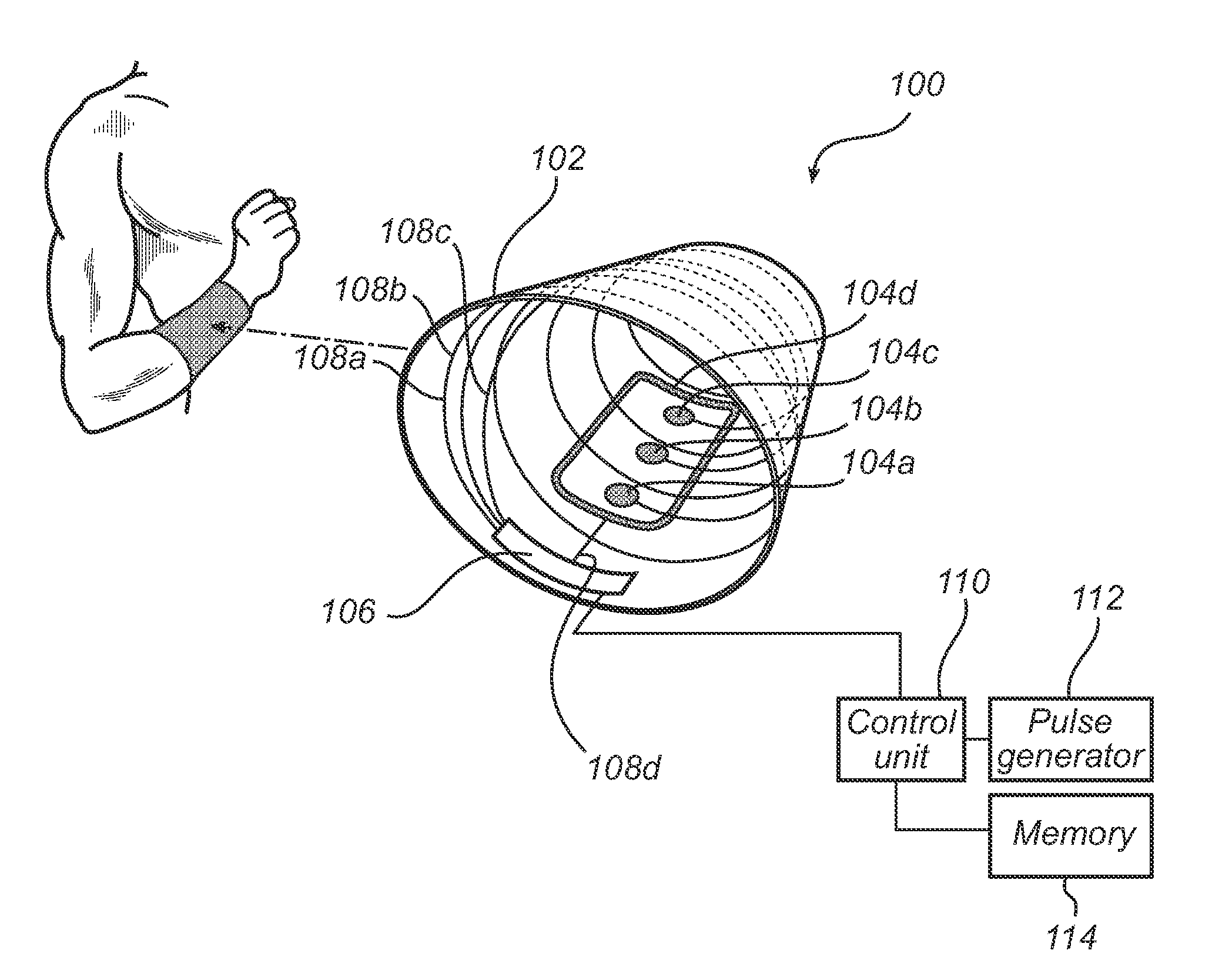 Wearable device and system for a tamper free electric stimulation of a body
