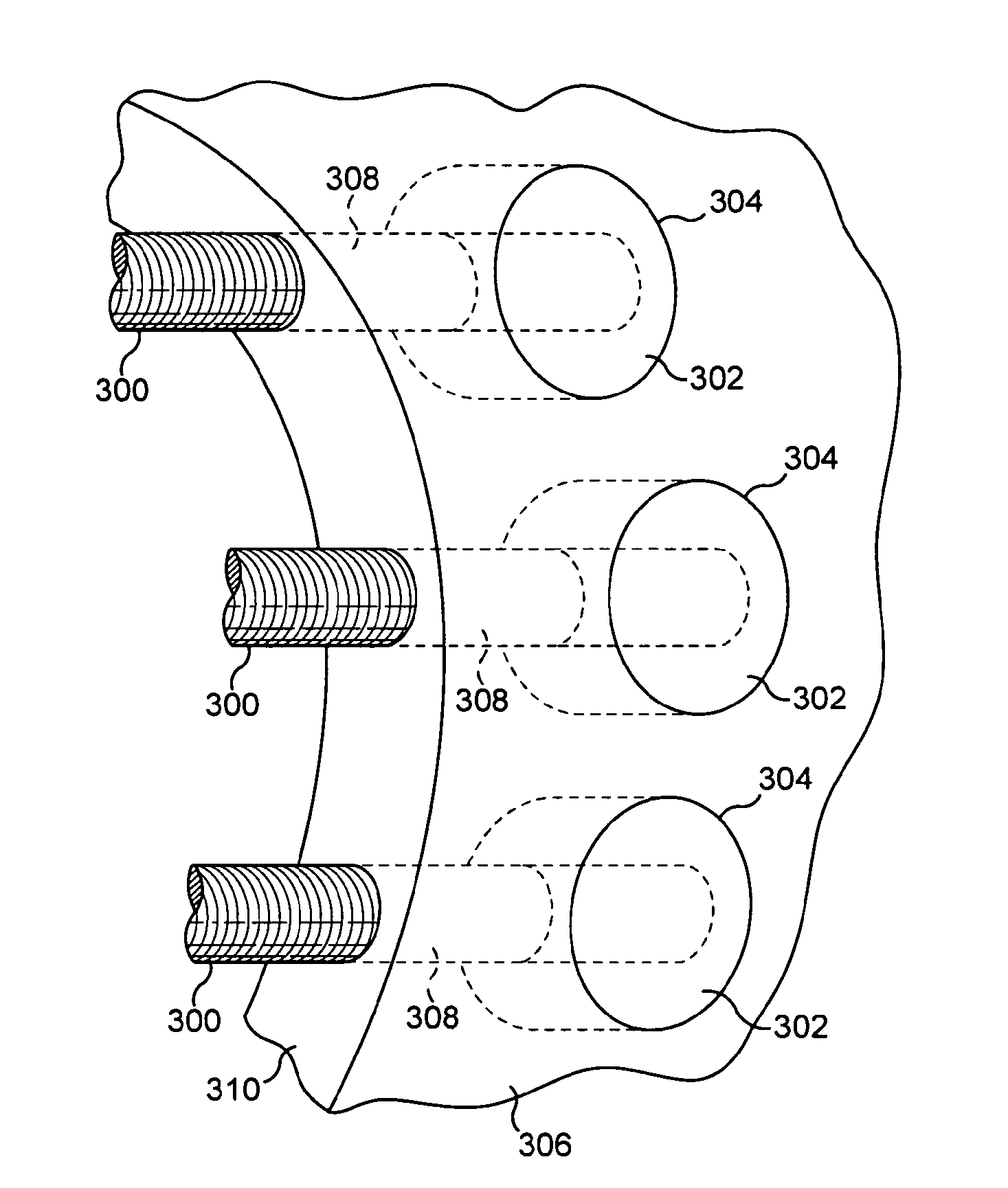 Wind or tidal turbine blade having an attachment