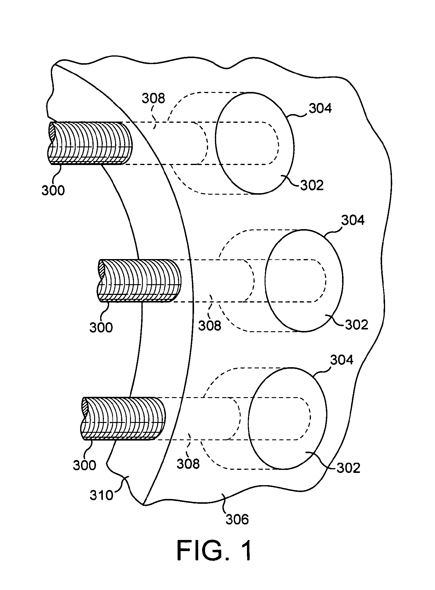 Wind or tidal turbine blade having an attachment