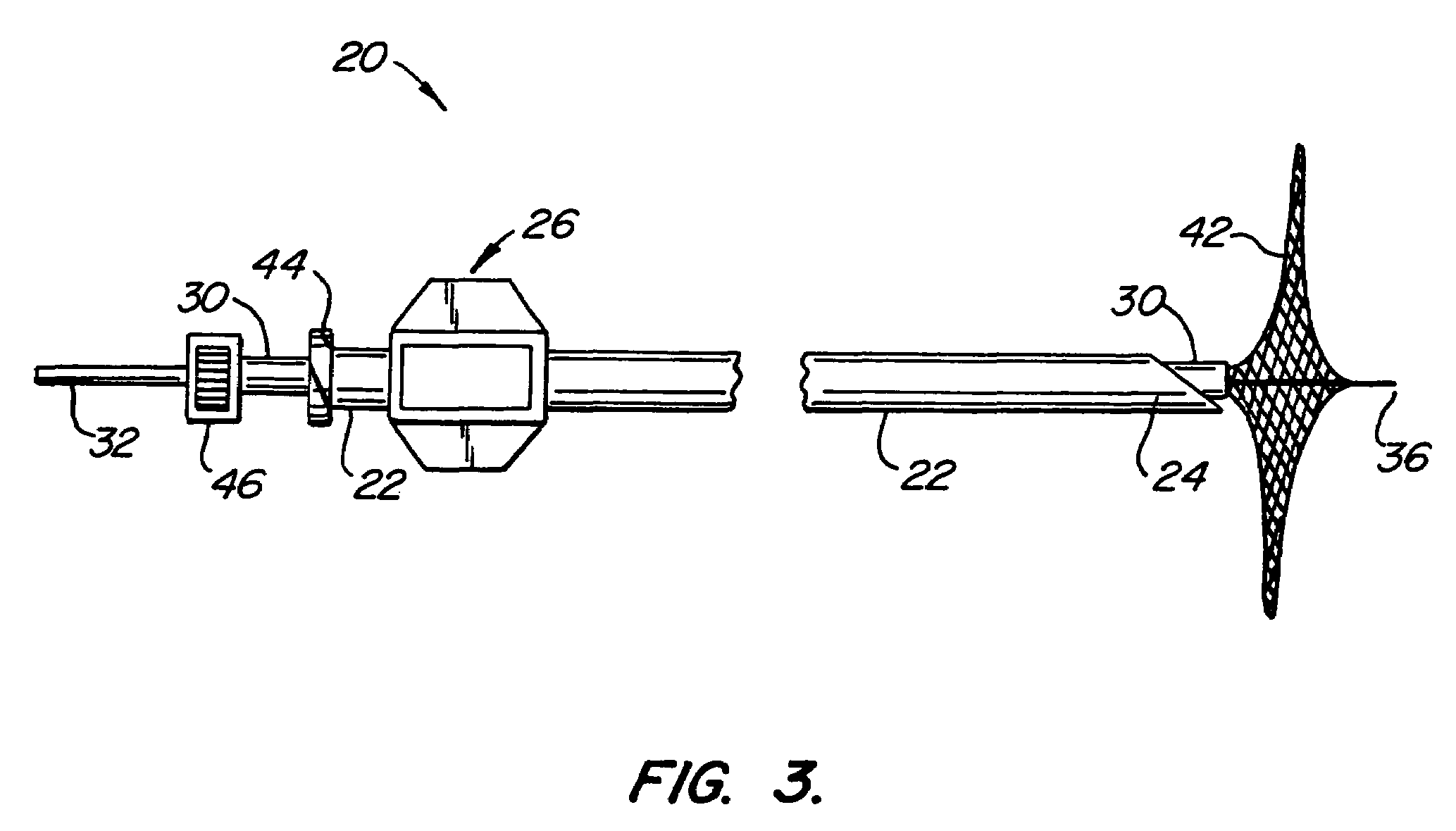 Target tissue localization device