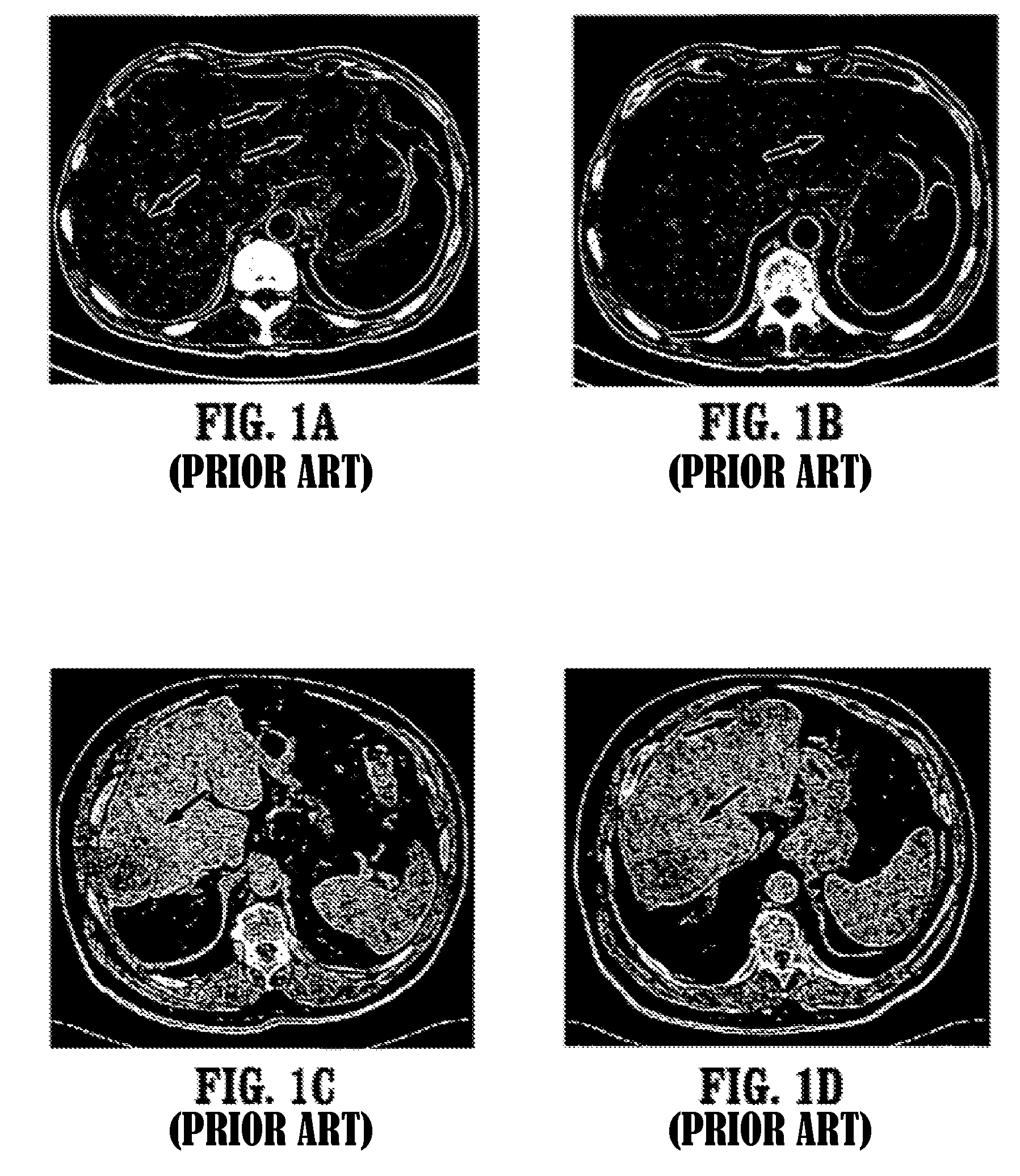 Systems and methods for segmenting object of interest from medical image