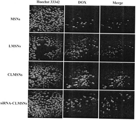 Preparation method of a cationic lipid-mesoporous silicon composite nanocarrier co-loading siRNA and chemotherapy drugs