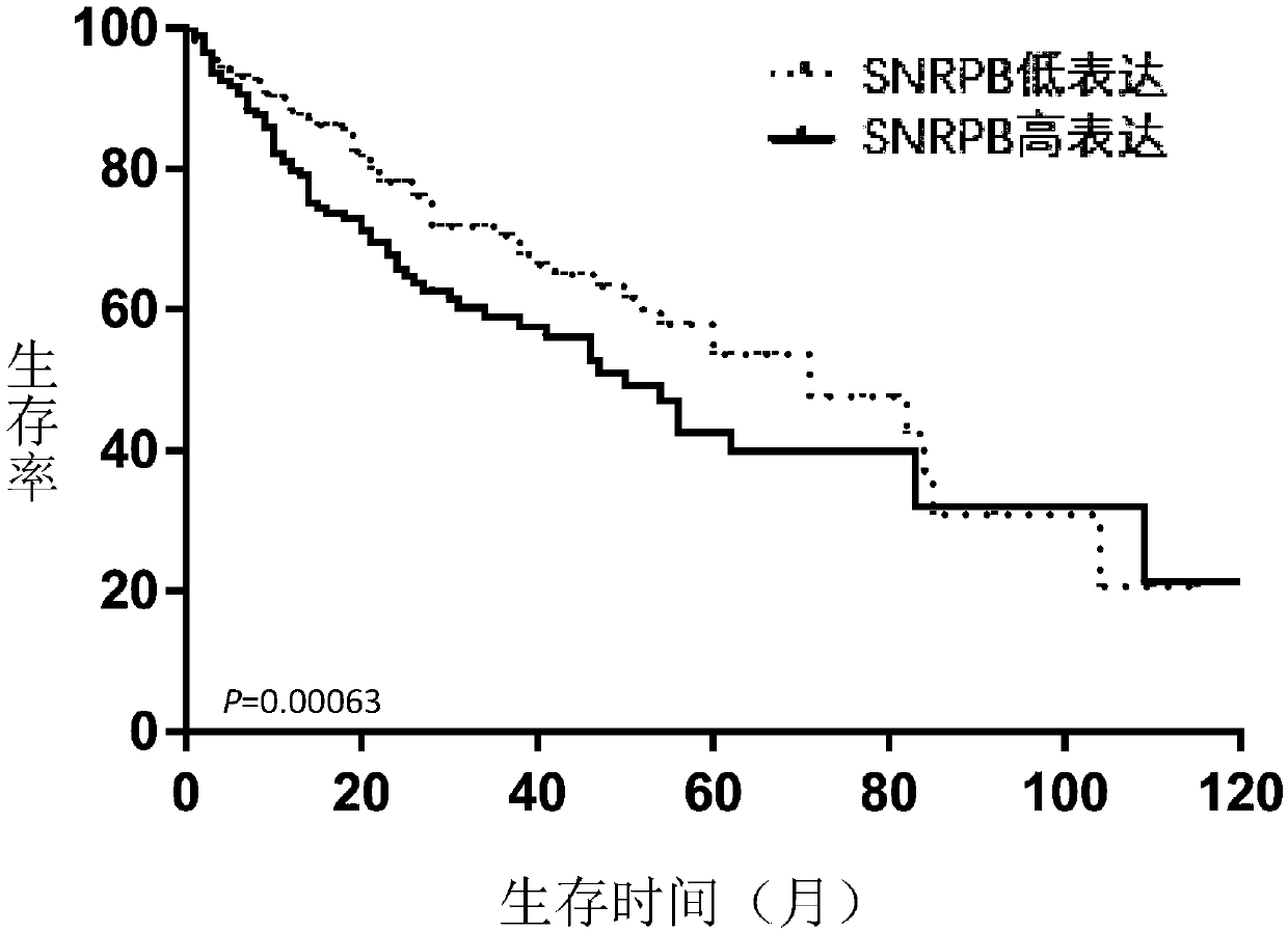 Application of SNRPB as biomarker in prognosis evaluation of hepatocellular carcinoma and kit containing biomarker