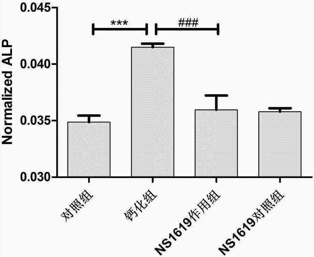Application of BK channel opener in establishing vascular smooth muscle cell calcification model