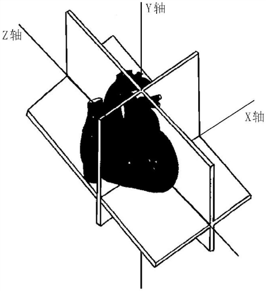 Left ventricle center and region of interest extraction method, device adopting method and system