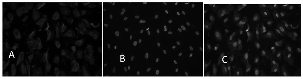 Separation and culture method of ovarian granular cells of northern Guizhou Ma goats