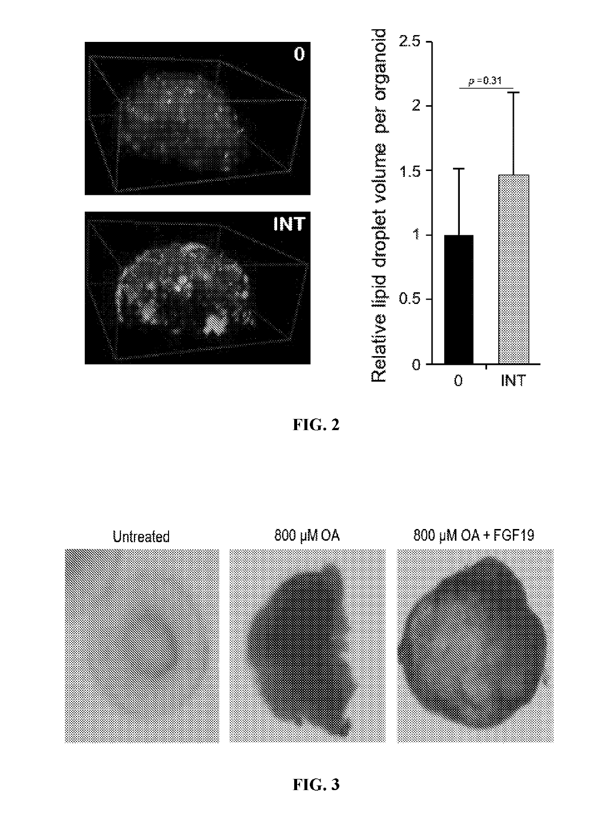 Compositions and methods of treating liver disease