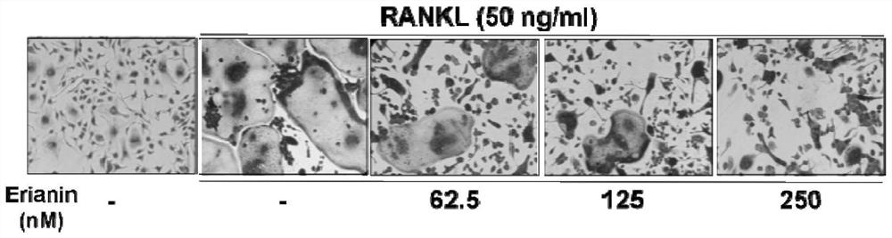 Application of erianin in preparation of osteoclast differentiation inhibitor