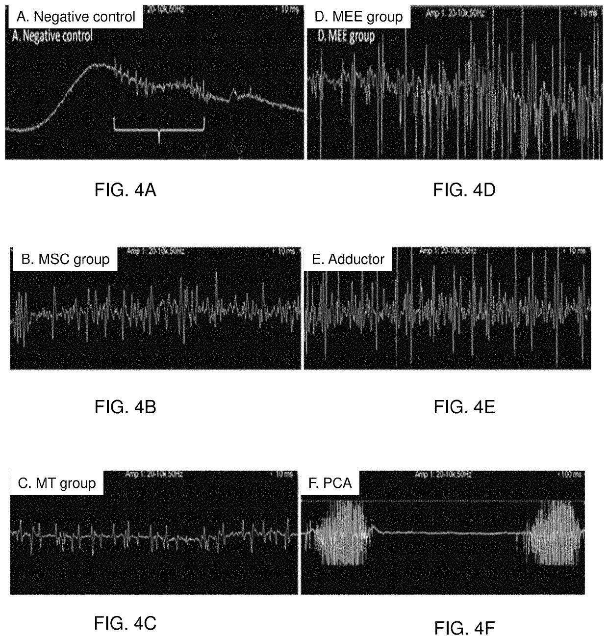 Primed muscle progenitor cells and uses thereof