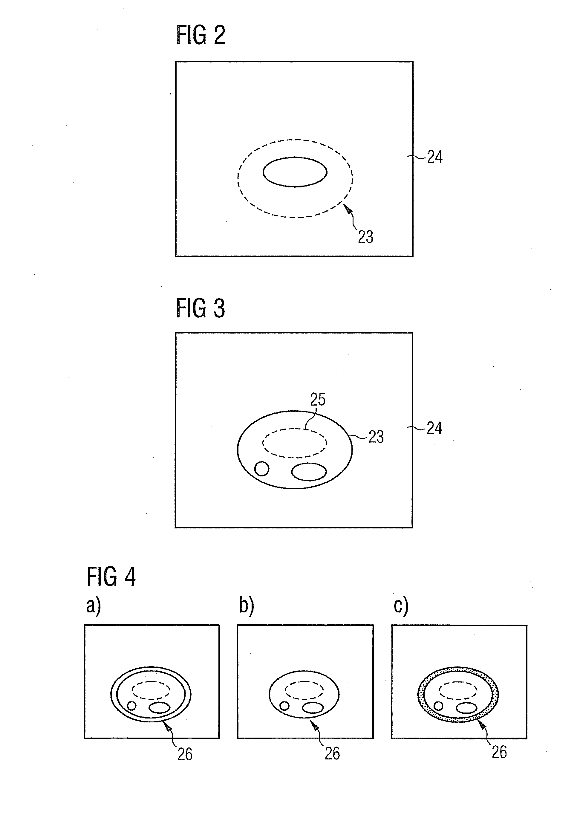 Method For Generating MR Images And An Appropriately Designed Magnetic Resonance System